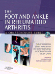 The Foot And Ankle In Rheumatoid Arthritis A Comprehensive Guide Philip Helliwell