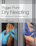 Trigger Point Dry Needling An Evidence And Clinicalbased Approach Jan Dommerholt And Csar Fernndezdelaspeas