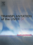 Transplantation Of The Liver Ronald W Busuttil Md Phd And Goran K Klintmalm