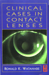 Clinical Cases In Contact Lenses Ronald K Watanabe Od Faao Eds