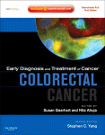 Early Diagnosis And Treatment Of Cancer Series Colorectal Cancer Susan Gearhart