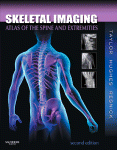 Skeletal Imaging John A M Taylor Tudor H Hughes Donald Resnick