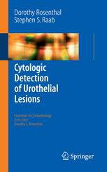 Cytologic Detection Of Urothelial Lesions 1st Edition Dorothy L Rosenthal Md