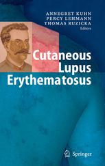 Cutaneous Lupus Erythematosus Thomas M Herndon George C Tsokos Auth