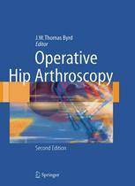 Operative Hip Arthroscopy Jw Thomas Byrd Auth Jw Thomas Byrd Md Eds