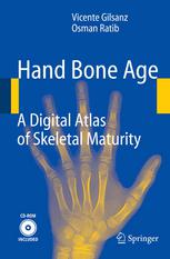 Hand Bone Age A Digital Atlas Of Skeletal Maturity Vicente Gilsanz Md