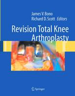 Revision Total Knee Arthroplasty 1st Edition Richard D Scott Auth