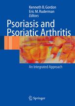 Psoriasis And Psoriatic Arthritis An Integrated Approach 1st Edition Kenneth B Gordon Md