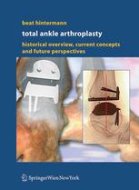 Total Ankle Arthroplasty Historical Overview Current Concepts And Future Perspectives 1st Edition Prof Dr Beat Hintermann Auth