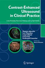 Contrastenhanced Ultrasound In Clinical Practice Liver Prostate Pancreas Kidney And Lymph Nodes 1st Edition Thomas Albrecht