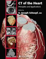 Ct Of The Heart Principles And Applications 1st Edition William Stanford Md Auth