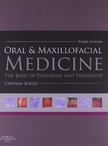 Oral And Maxillofacial Medicine The Basis Of Diagnosis And Treatment 3e 3rd Edition Crispian Scully