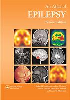 Atlas Of Epilepsy 2nd Richard Appleton D F Smith