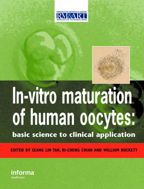 In Vitro Maturation Of Human Oocytes Basic Science To Clinical Application Seang Lin Tan