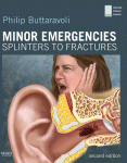 Minor Emergencies Splinters To Fractures Philip Buttaravoli