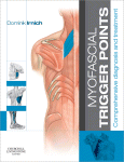Myofascial Trigger Points Comprehensive Diagnosis And Treatment Dominik Irnich