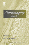 Neuroimaging Part A Michael F Glabus Eds