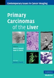 Primary Carcinomas Of The Liver 1st Edition Hero K Hussain Isaac R Francis