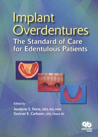 Implant Overdentures The Standard Of Care For Edentulous Patients 1st Edition Jocelyne S Feine