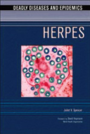 Herpes Juliet V Spencer