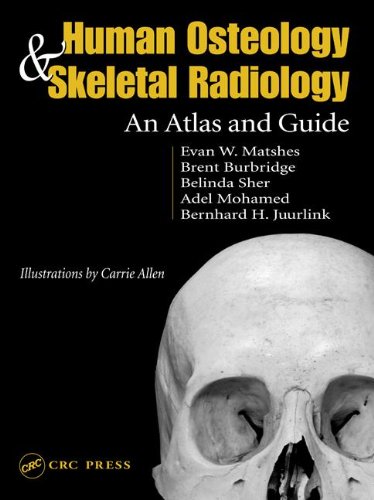 Human Osteology And Skeletal Radiology An Atlas And Guide 1st Edition Evan W Matshes