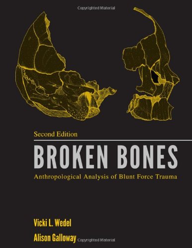 Broken Bones Anthropological Analysis Of Blunt Force Trauma Second Vicki L Wedel