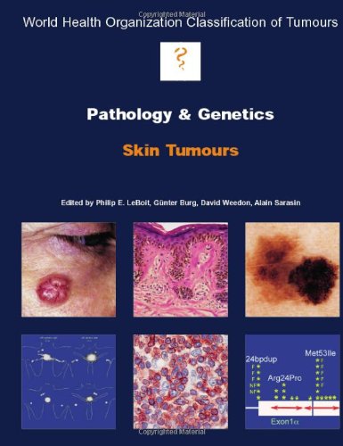 Pathology And Genetics Of Skin Tumours 1st Edition The International Agency For Research On Cancer