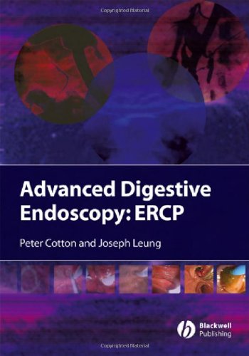 Advanced Digestive Endoscopy Ercp 1st Edition Peter B Cotton