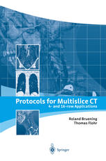 Protocols For Multislice Ct 4 And 16row Applications Roland Bruening