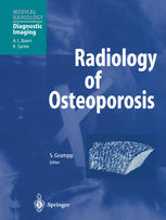 Radiology Of Osteoporosis P Pietschmann Md R Gruber M Peterlik Auth