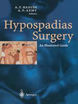 Hypospadias Surgery An Illustrated Guide Cenk Byknal Auth
