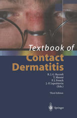 Textbook Of Contact Dermatitis Jeanmarie Lachapelle Auth