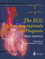 The Ecg A Twostep Approach To Diagnosis 1st Edition Professor Dr Marc Gertsch Auth