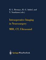 Intraoperative Imaging In Neurosurgery Mri Ct Ultrasound 1st Edition R L Bernays Auth