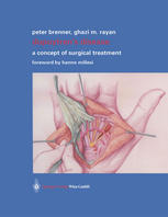 Dupuytrens Disease A Concept Of Surgical Treatment Peter Brenner Md Phd