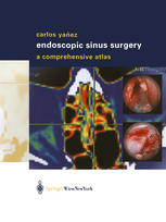 Endoscopic Sinus Surgery A Comprehensive Atlas 1st Edition Carlos Yaez Md Auth