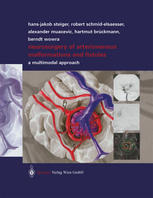 Neurosurgery Of Arteriovenous Malformations And Fistulas A Multimodal Approach Univprof Dr Hansjakob Steiger