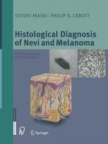 Histological Diagnosis Of Nevi And Melanoma Prof Guido Massi Md