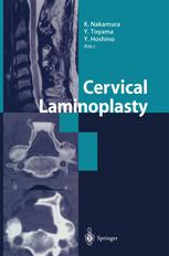 Cervical Laminoplasty 1st Edition Kozo Nakamura Atsushi Seichi Auth