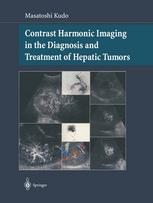 Contrast Harmonic Imaging In The Diagnosis And Treatment Of Hepatic Tumors 1st Edition Masatoshi Kudo Md