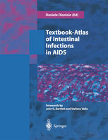 Textbookatlas Of Intestinal Infections In Aids Daniele Dionisio Auth