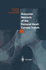 Avascular Necrosis Of The Femoral Head Current Trends 1st Edition E De Santis