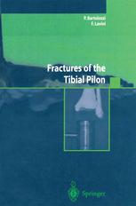 Fractures Of The Tibial Pilon 1st Edition P Bartolozzi F Lavini Auth