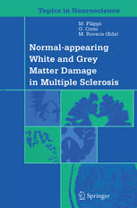 Normalappearing White And Grey Matter Damage In Multiple Sclerosis 1st Edition W Brck