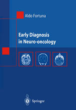 Early Diagnosis In Neurooncology 1st Edition Aldo Fortuna Md Auth