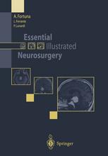 Essential Illustrated Neurosurgery 1st Edition Aldo Fortuna Md
