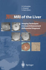 Mri Of The Liver Imaging Techniques Contrast Enhancement Differential Diagnosis Gnther Schneider Md