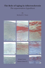 The Role Of Aging In Atherosclerosis The Sequestration Hypothesis 1st Edition Richard E Tracy Md Phd Auth
