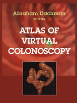Atlas Of Virtual Colonoscopy David J Vining Auth Abraham H Dachman Md Eds