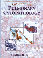 Color Atlas Of Pulmonary Cytopathology 1st Edition Sudha R Kini Md Auth